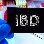 How to Start an Effective IBD Journal