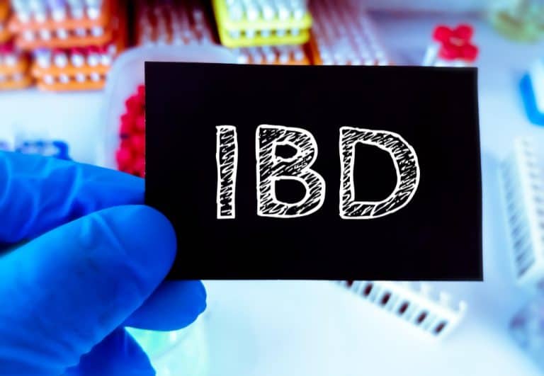 How to Start an Effective IBD Journal